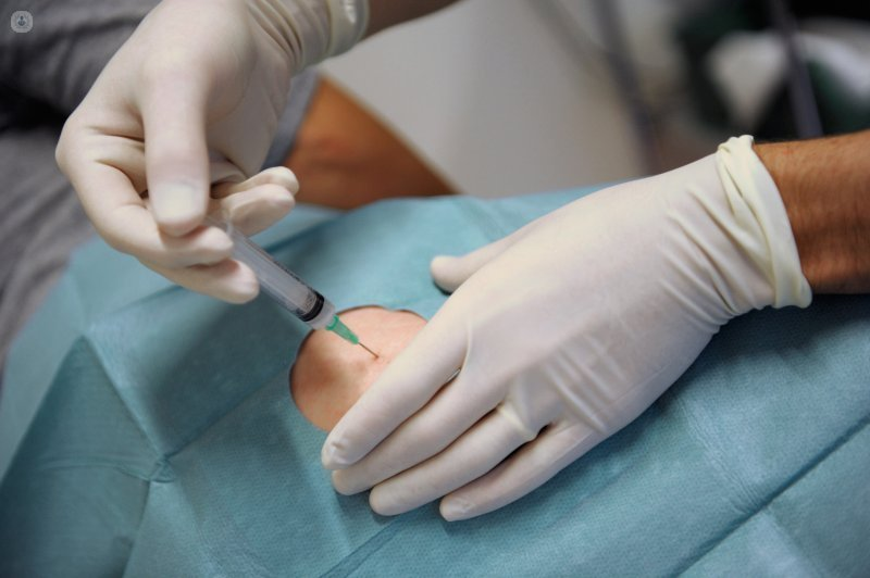 Ozonoterapia Uretral